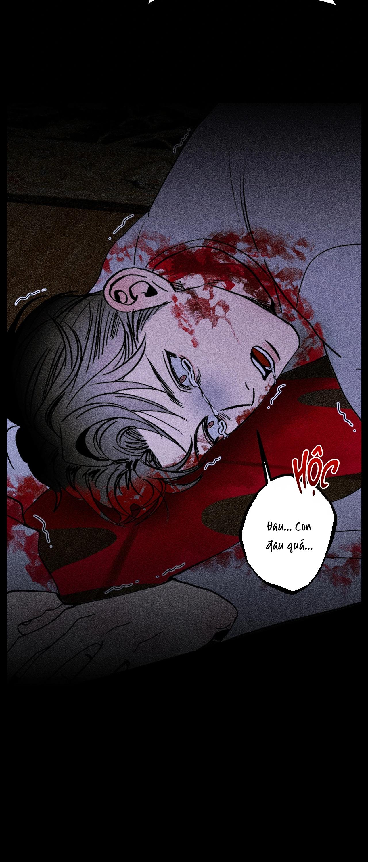 KISS THE TRAUMA Chapter 1 - Trang 2