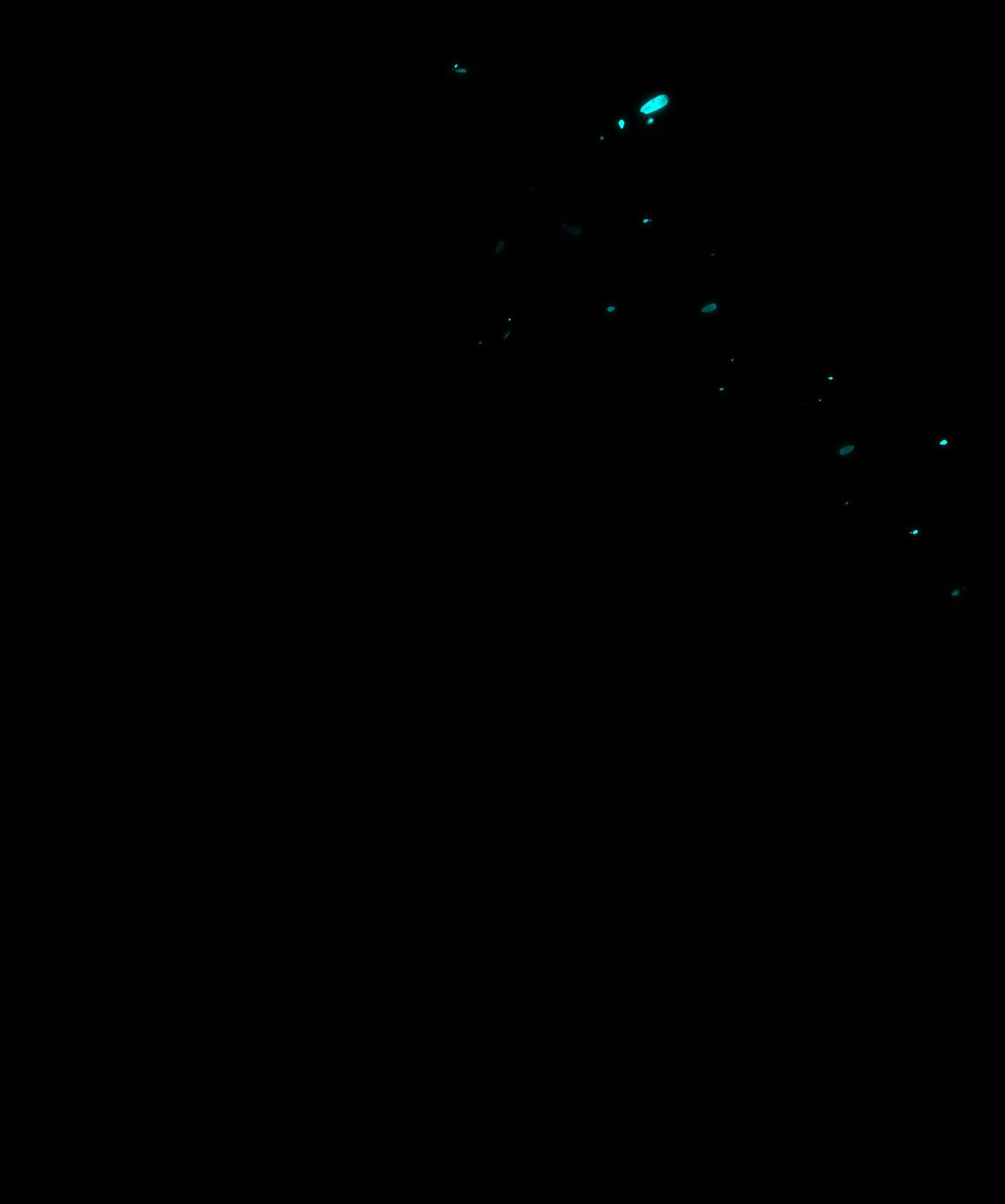 Á NÔ 2 - THÁM HOA Chapter 87 - Next Chapter 88