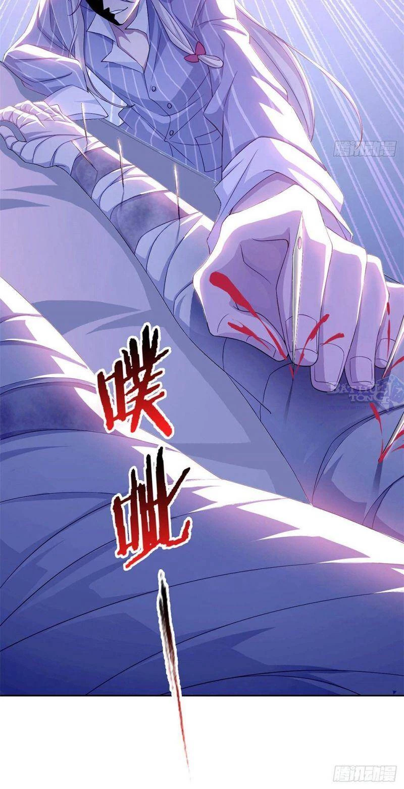 Cường Giả Đến Từ Trại Tâm Thần Chapter 2 - Trang 4