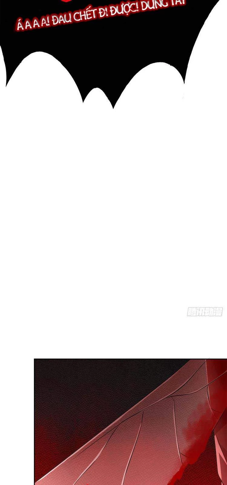 Cường Giả Đến Từ Trại Tâm Thần Chapter 45 - Trang 4