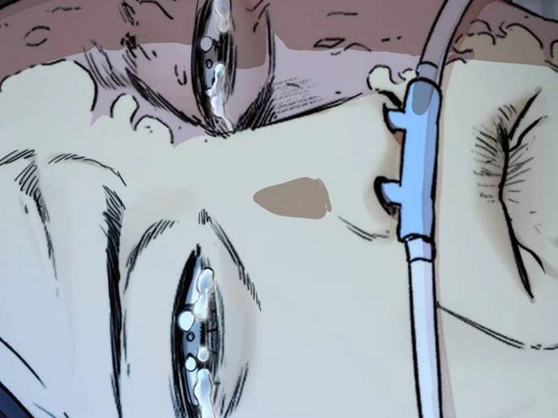 Thể Thao Cực Hạn Chapter 494 - Trang 4