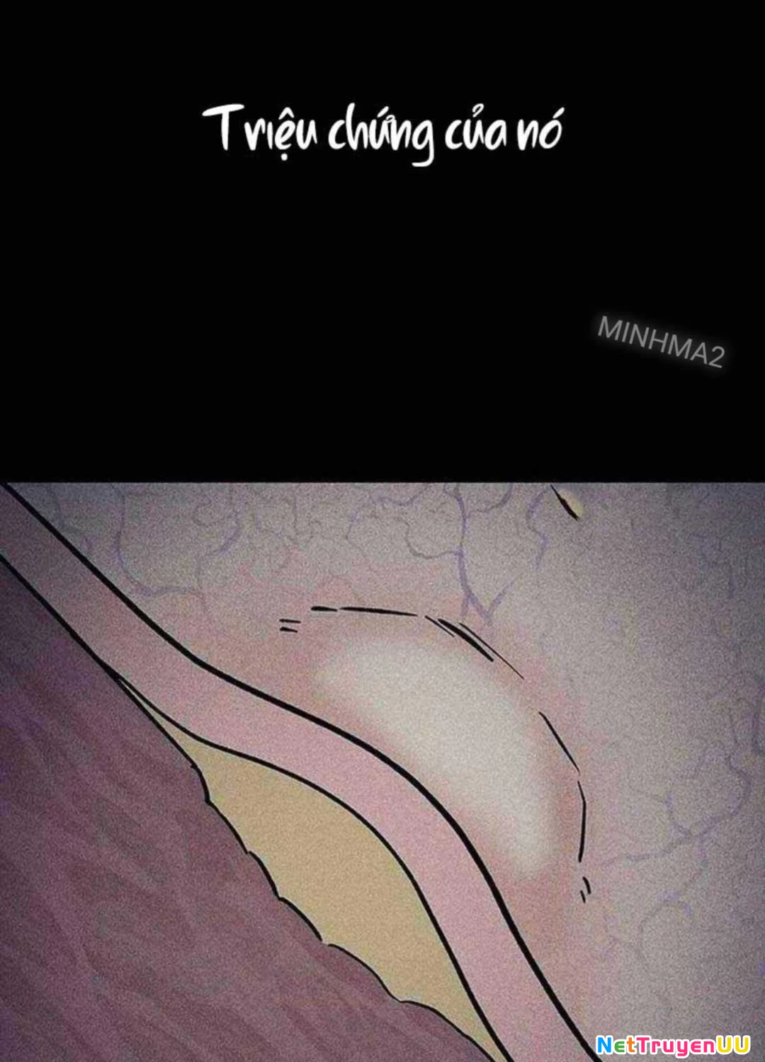 Bác Sĩ Tới Joseon Chapter 13 - Trang 3